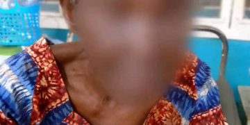 Kongo Central : une femme de 89 ans aurait été victime d&rsquo;une agression sexuelle à Kimpese