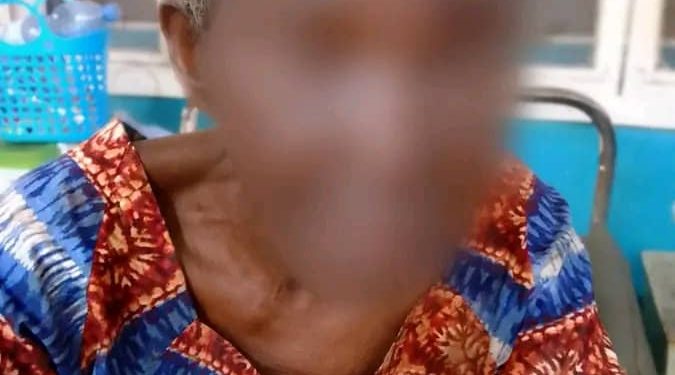 Kongo Central : une femme de 89 ans aurait été victime d’une agression sexuelle à Kimpese