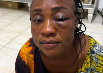 Kongo central : Violences présumées contre Diana Liongi : la Tribune des Femmes de Médias exige que justice soit rendue