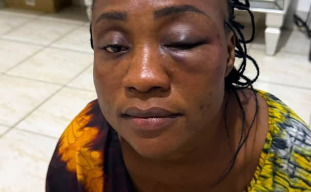 Kongo central : Violences présumées contre Diana Liongi : la Tribune des Femmes de Médias exige que justice soit rendue